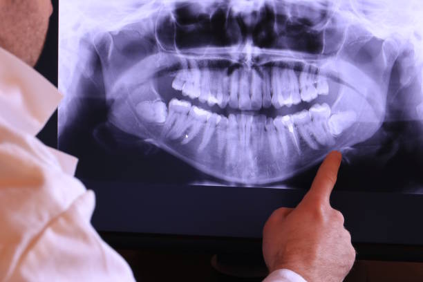 Best Emergency Gum Treatment in Towaoc, CO