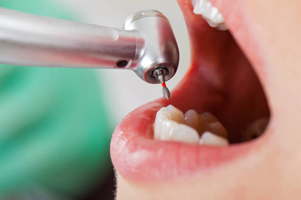 Best Emergency Treatment for Dental Infections or Abscesses in Towaoc, CO